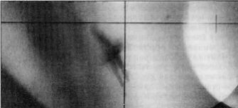 Image3.gif